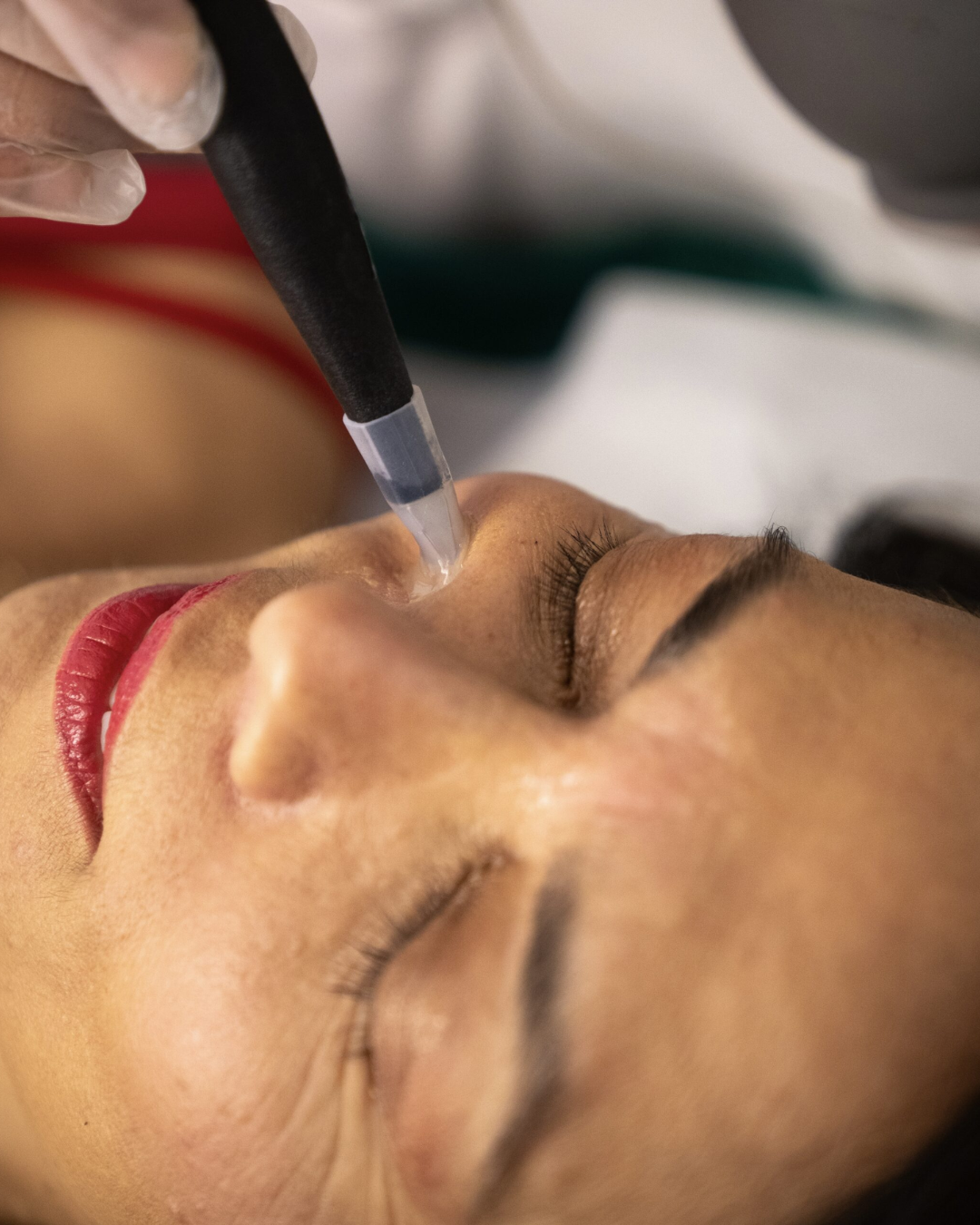 Gros plan sur une séance REYU Visage : la pièce à main REYU au coin de l'œil